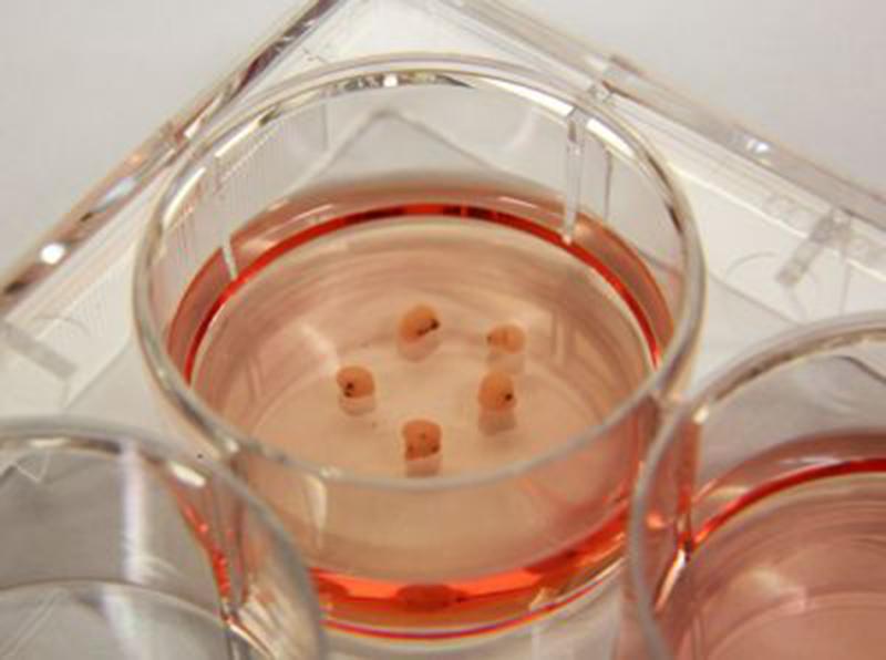 Minibrains in Petri Dish